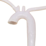 Aortic Arch